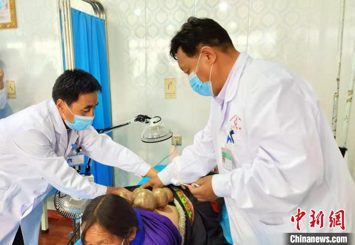 圖為看照加手把手帶徒弟加老(左一)進行拔罐療法?！堟?攝